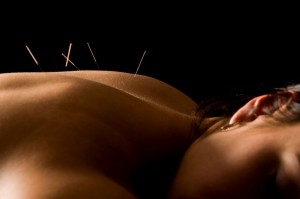 Acupuncture at Kingston Natural Health Centre