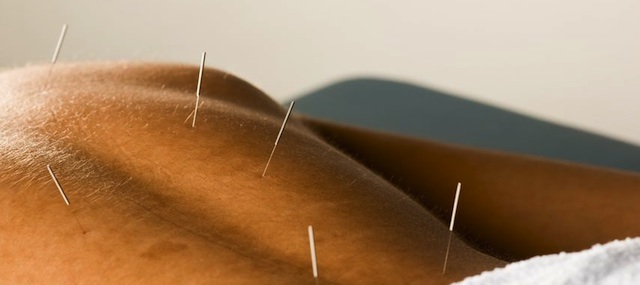 Acupuncture At Kingston Natural Health Centre