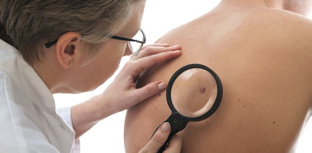 Skin Cancer Prevention