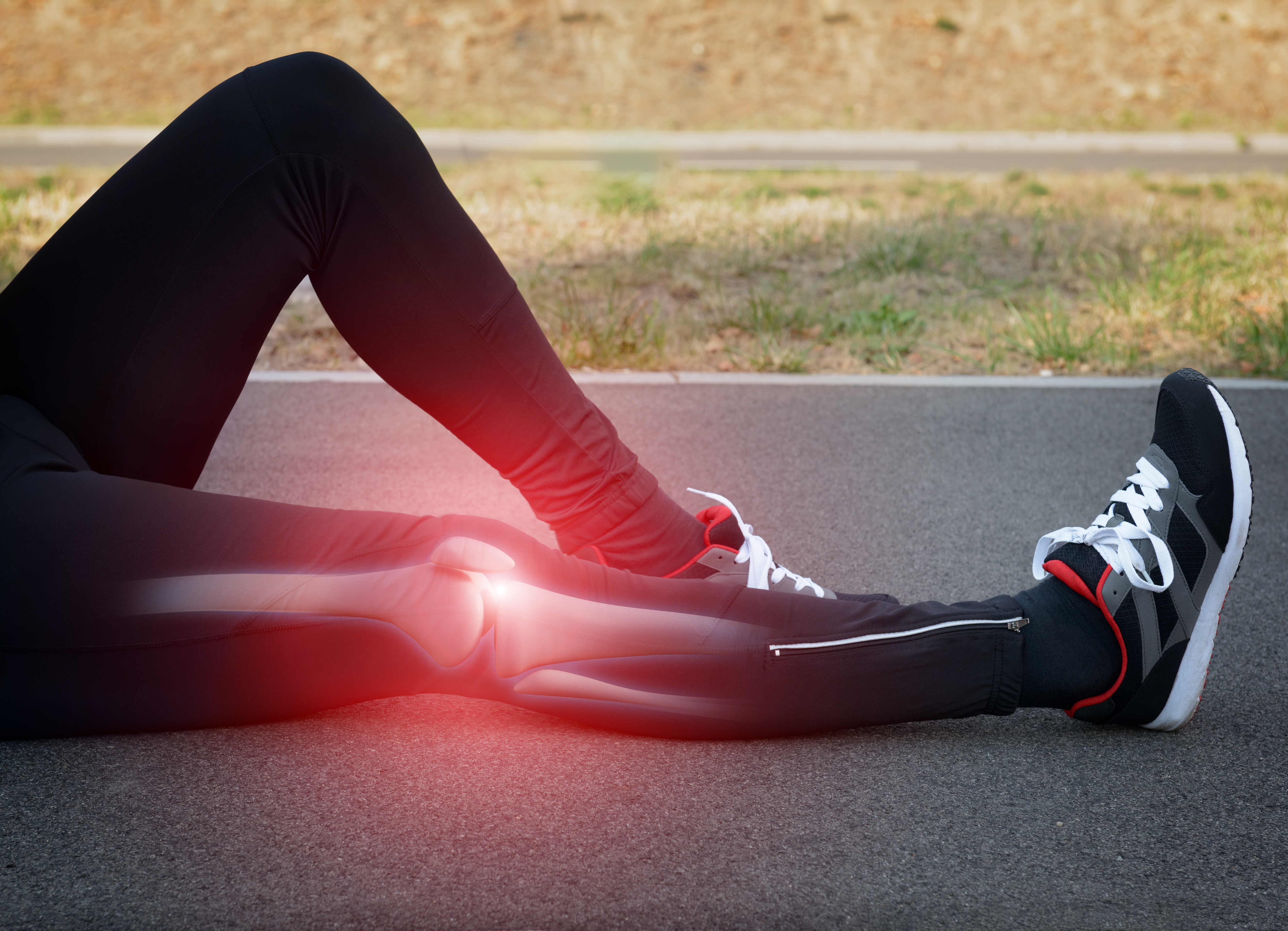 Runner Knee Injury And Pain With Leg Bones Visible